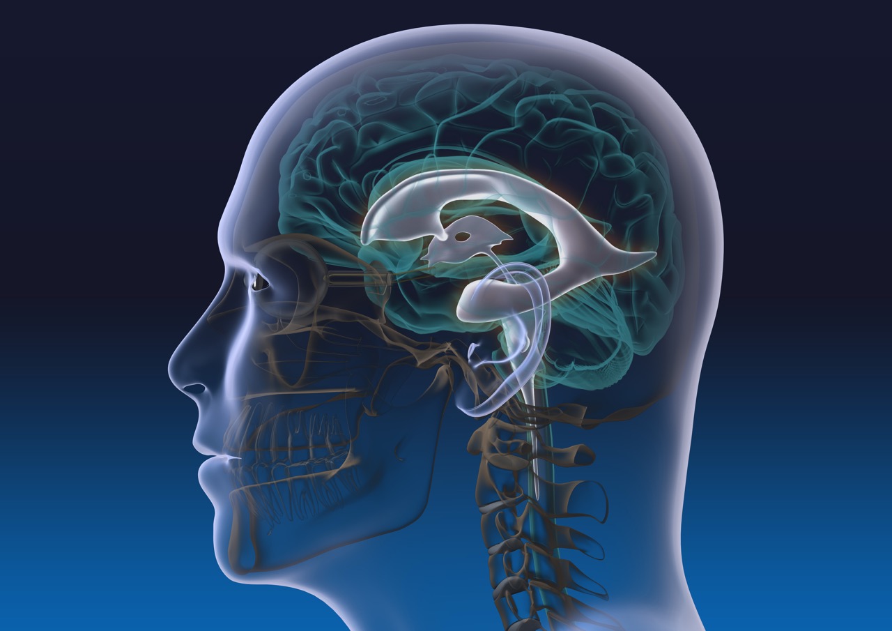 VP-Shunt Implantation