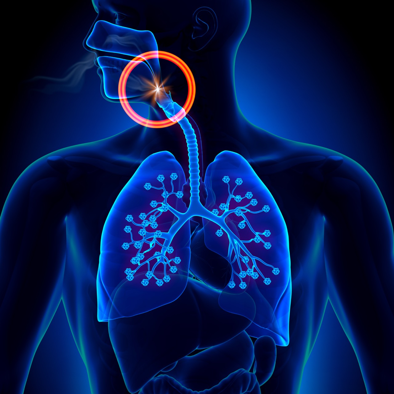 Zungenschrittmacher Bei obstruktiver Schlafapnoe (N.Hypoglossus Stimulation)